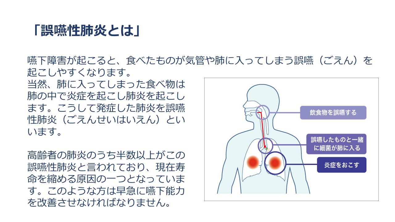 稲次病院 摂食嚥下 リハビリテーション